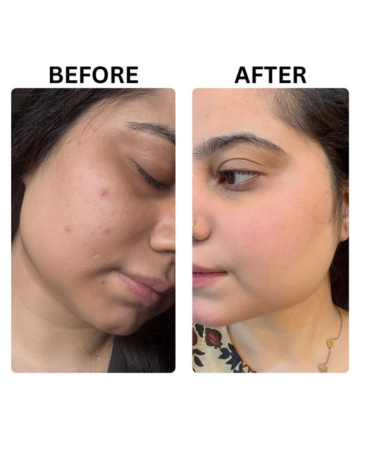 Zenova Skin Brightening Cream