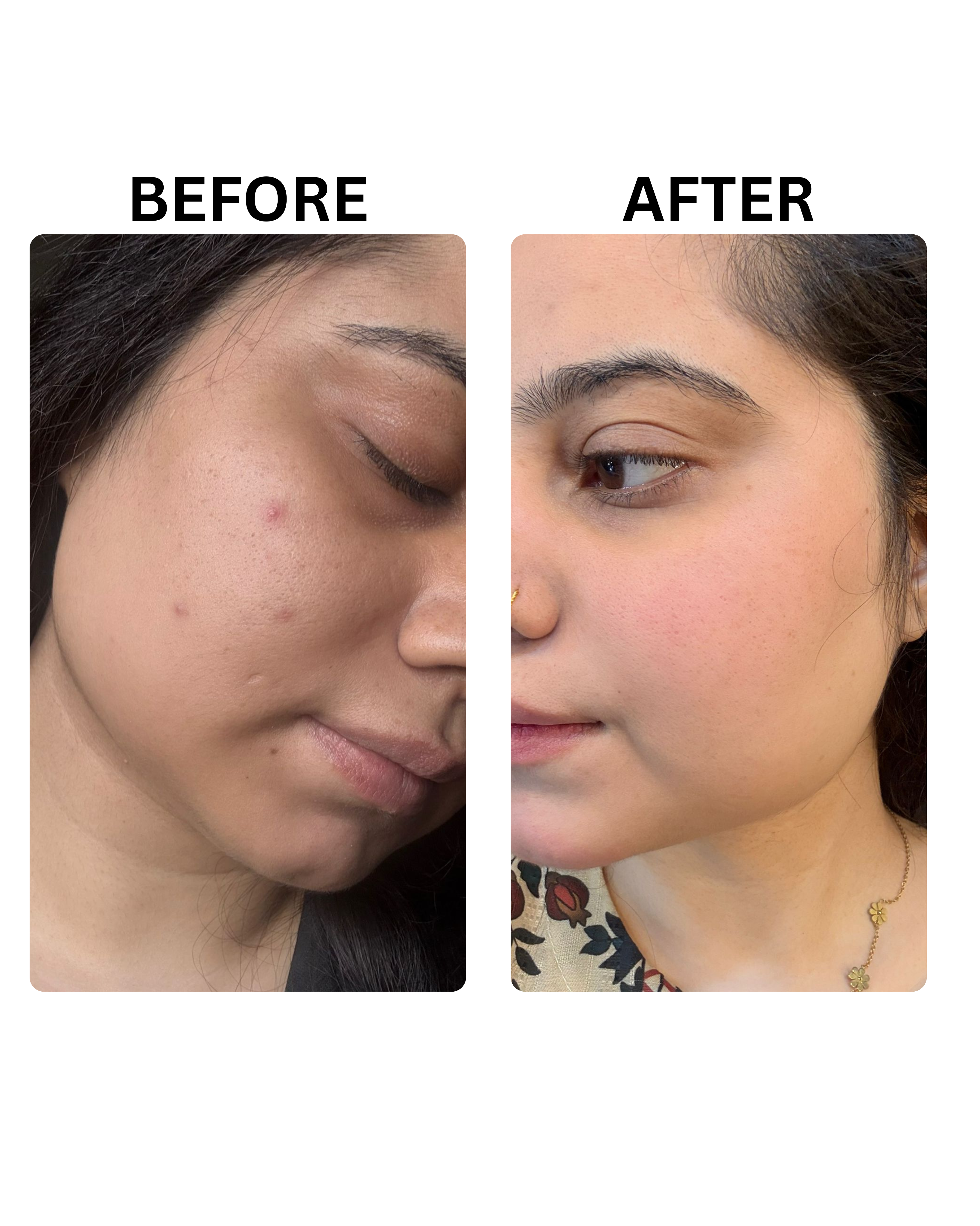 Pack of 2  Zenova Skin Brightening Cream