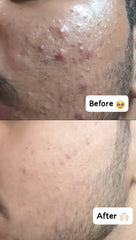 Zenova Face Cleanser